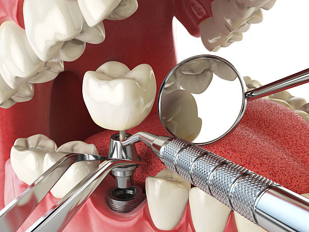 Best Emergency Dental Care for Trauma or Injury in Patrick Af, FL